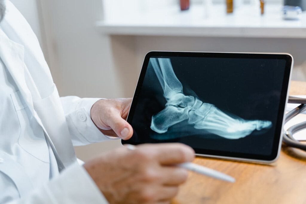 Radiographie d'un pied - Crédit photo: Tima Miroshnichenko | Pexels